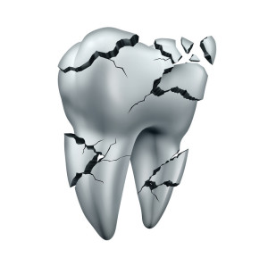 Chipped Tooth, Broken Tooth, North Boulder Dental Group
