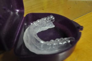 fitted-mouth-guard