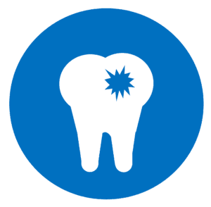 Cavity Or Tooth Decay 300x294.png